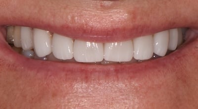 DSC 1261