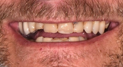 DSC 1581