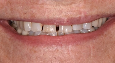 DSC 2571