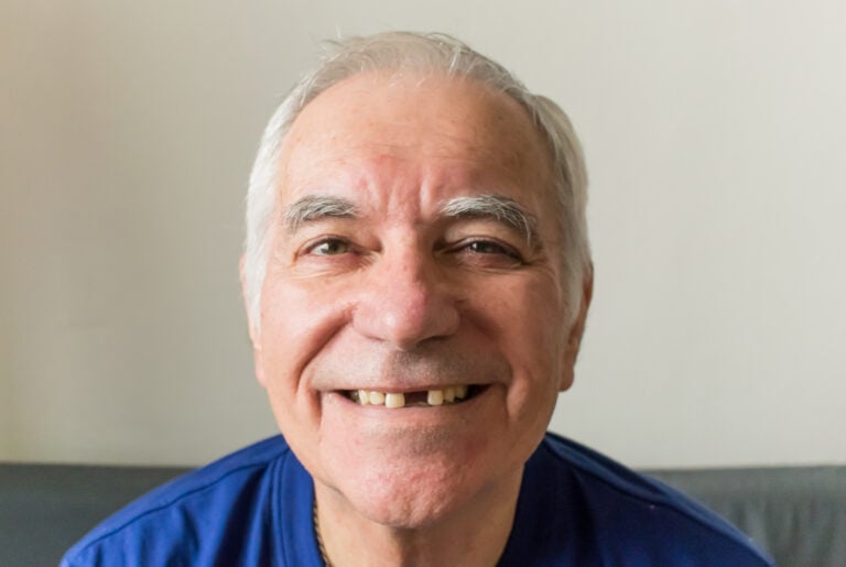 Dental Emergency? Steps to Take in the Aftermath
